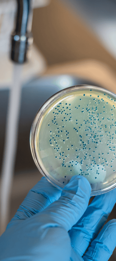 Gloved hand holding a culture plate of bacterial colonies beside a running tap